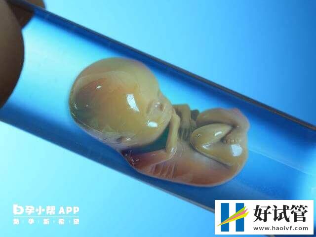 46岁自卵试管成功经验分享