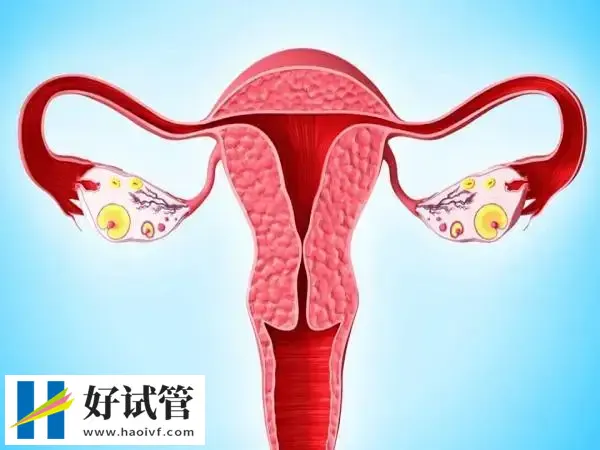 子宫内膜16做试管太厚了