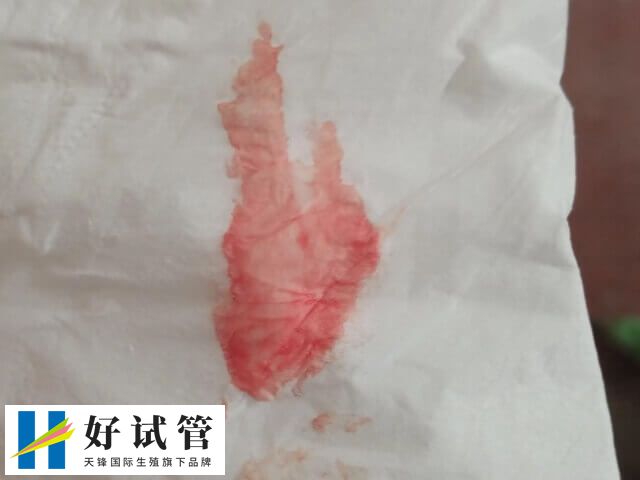 胚胎移植后着床出血的量少