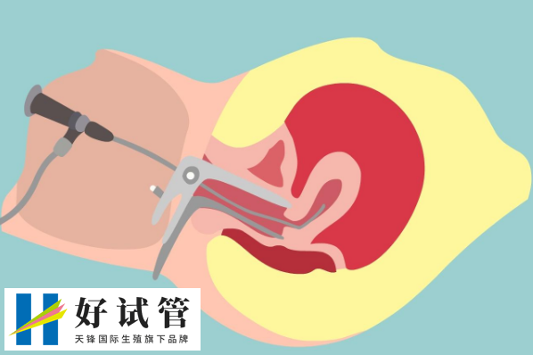 上海市不孕不育医院做试管婴儿一般得多钱?哪家医院成功率最高?(图1)