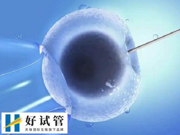 非法的性别筛选违反法律规定